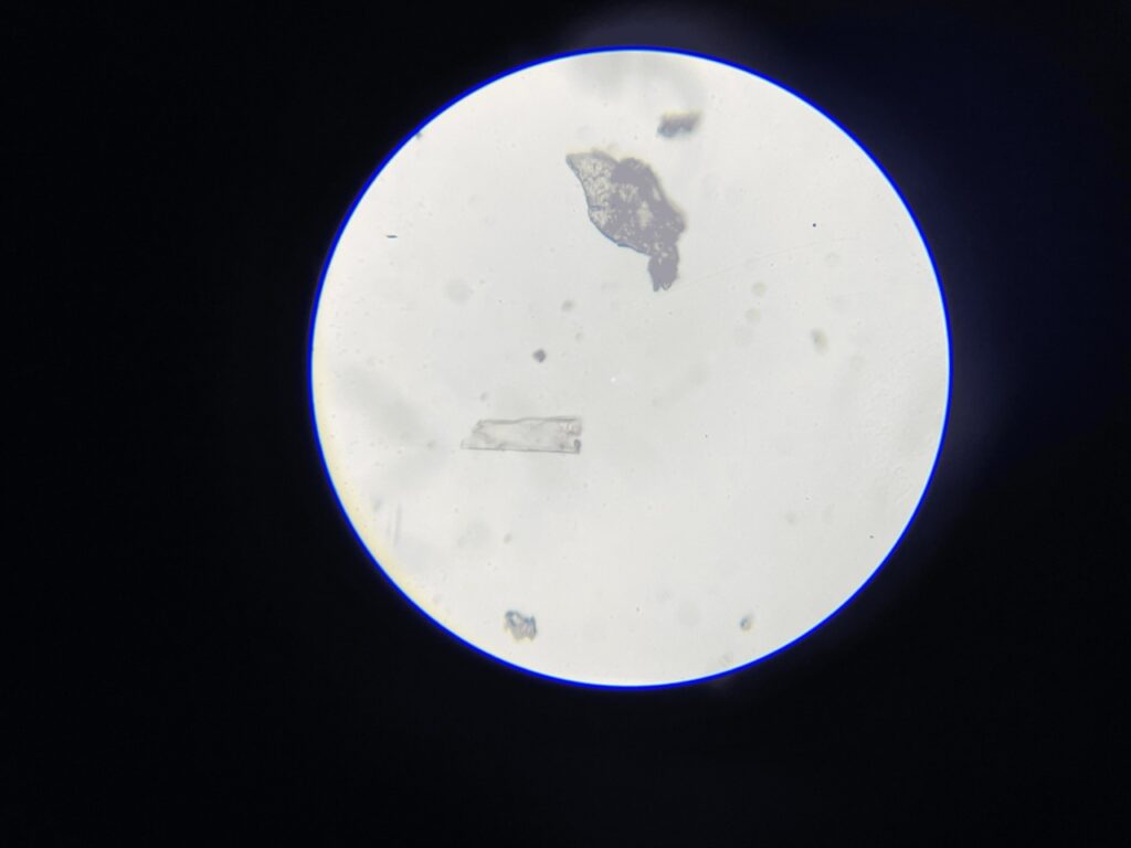 Human Sweat Under Microscope - 400x Large