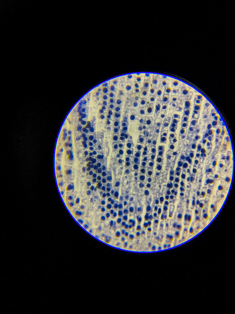 Allium (onion) root tip L.S. Under 400x Microscope