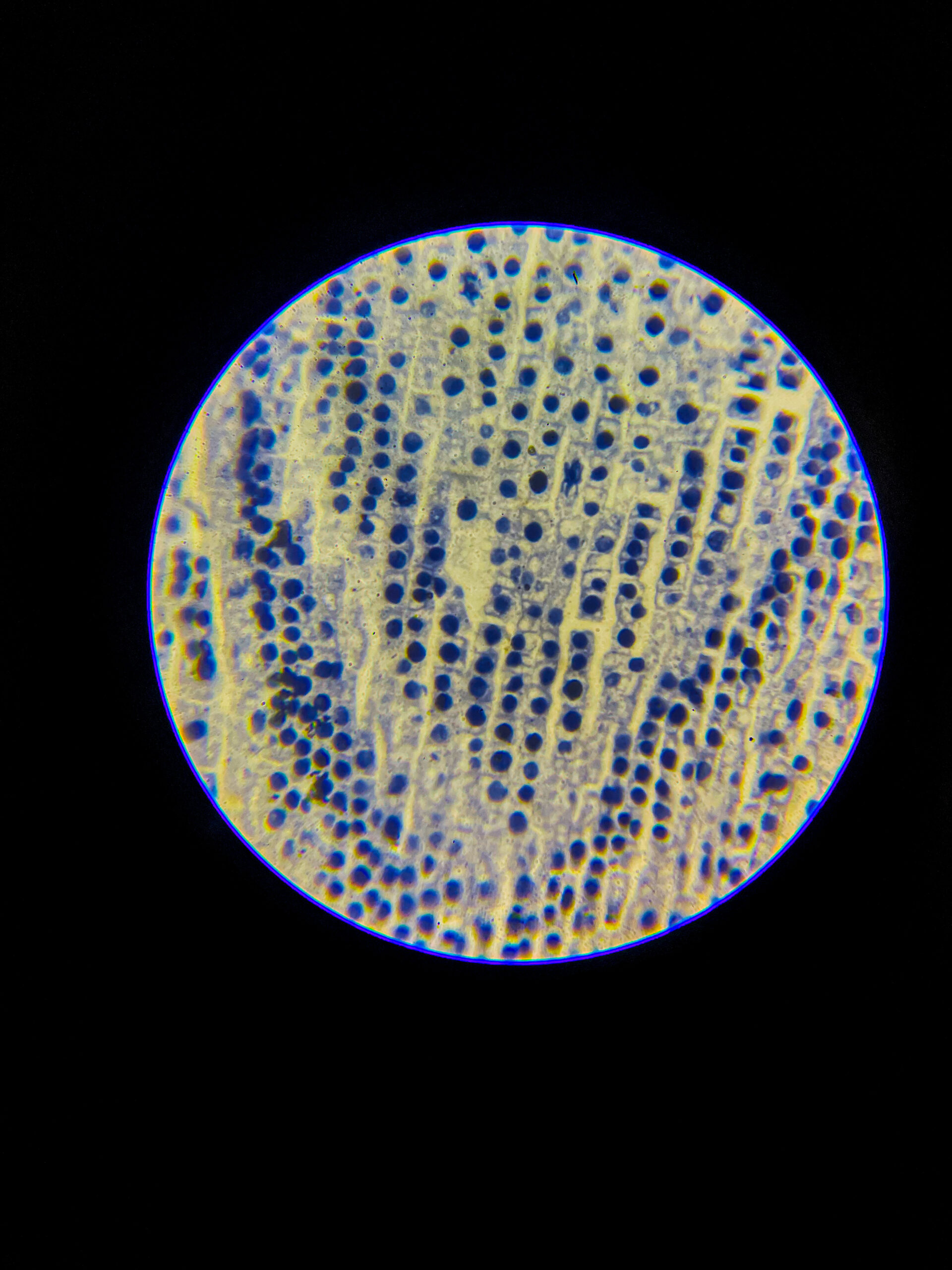 Allium (onion) root tip L.S. Under 400x Microscope