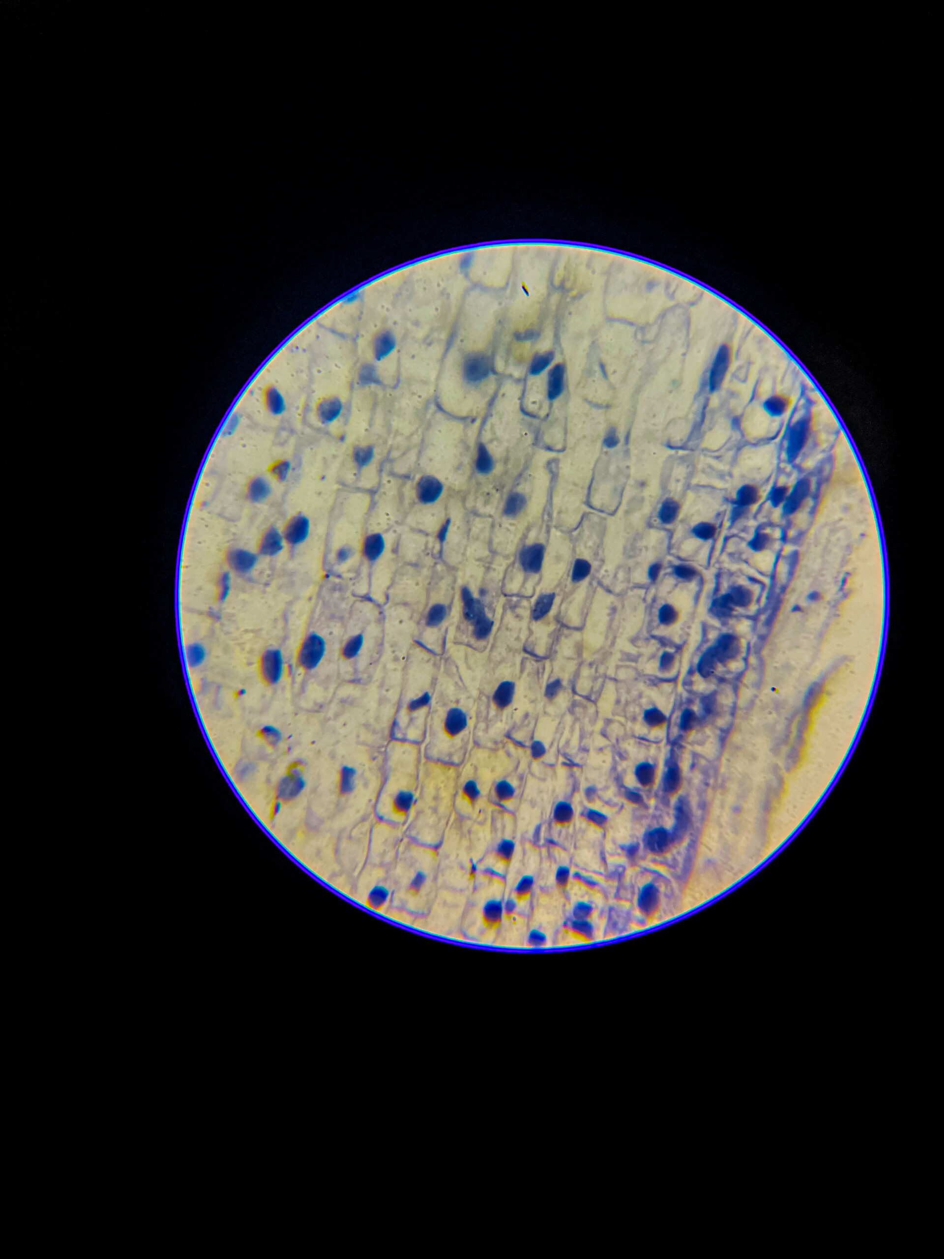 Allium (onion) root tip L.S. Under 400x Microscope