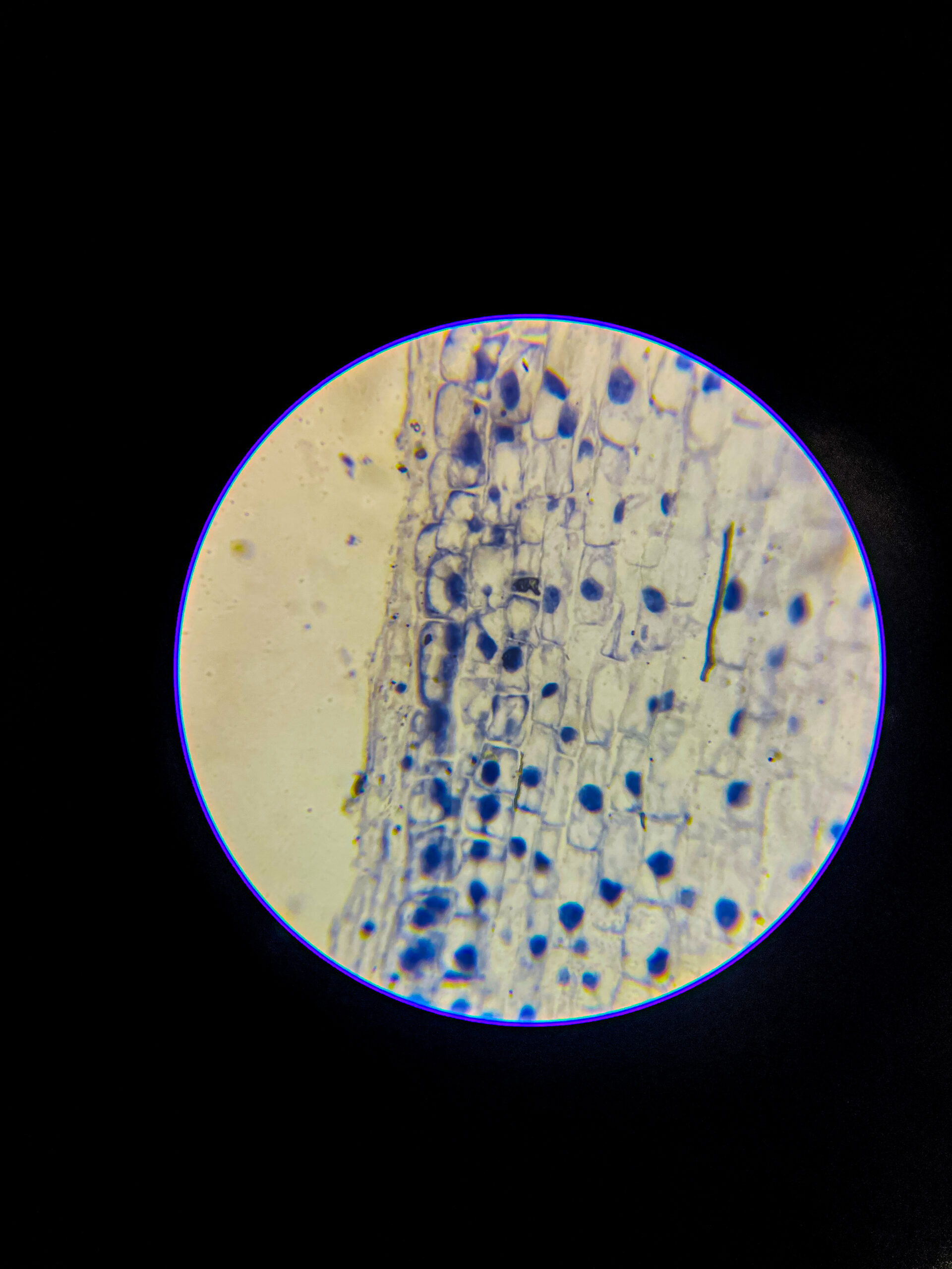 Allium (onion) root tip L.S. Under 400x Microscope