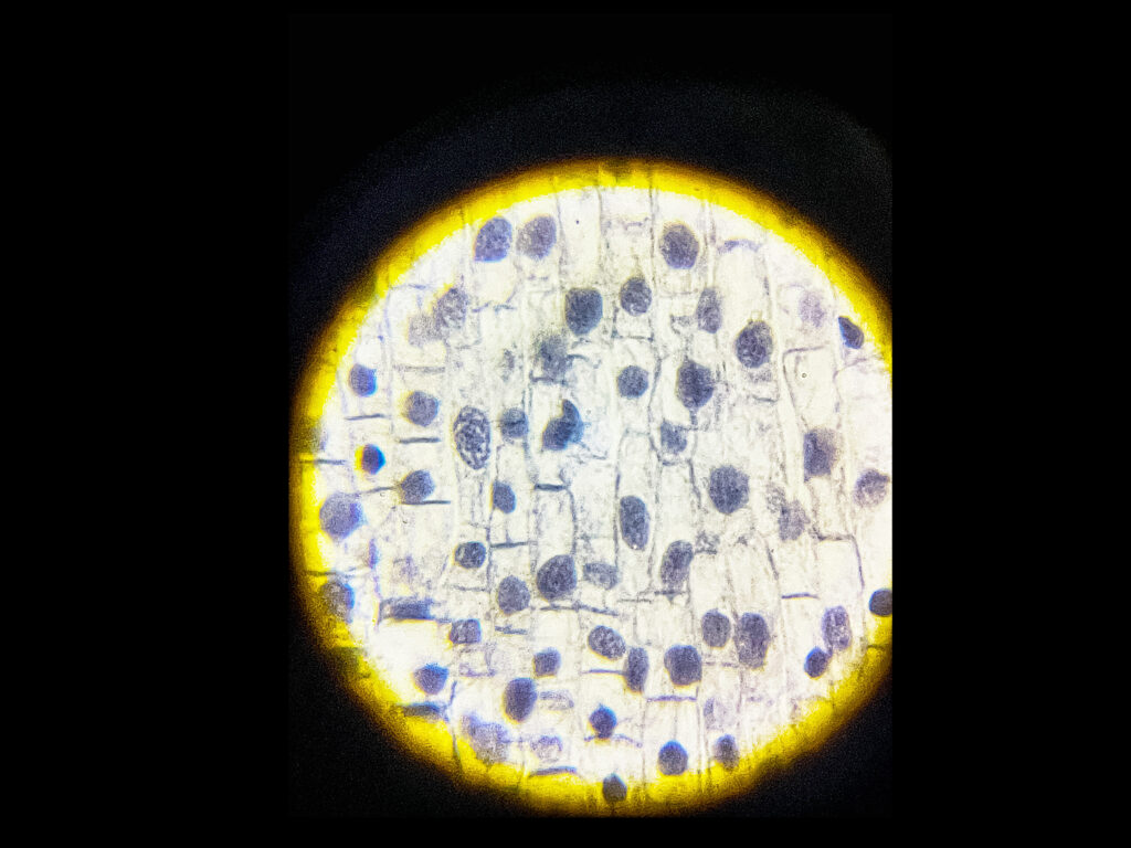 Onion Root Under Microscope - Mitosis Under Microscope-1000x