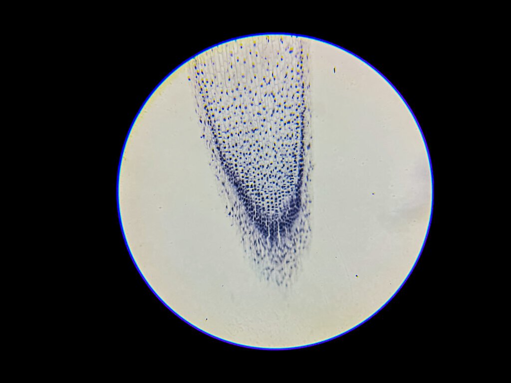 Onion Root Under Microscope - Mitosis Under Microscope 1 Onion Root Under Microscope - Mitosis Under Microscope-100x