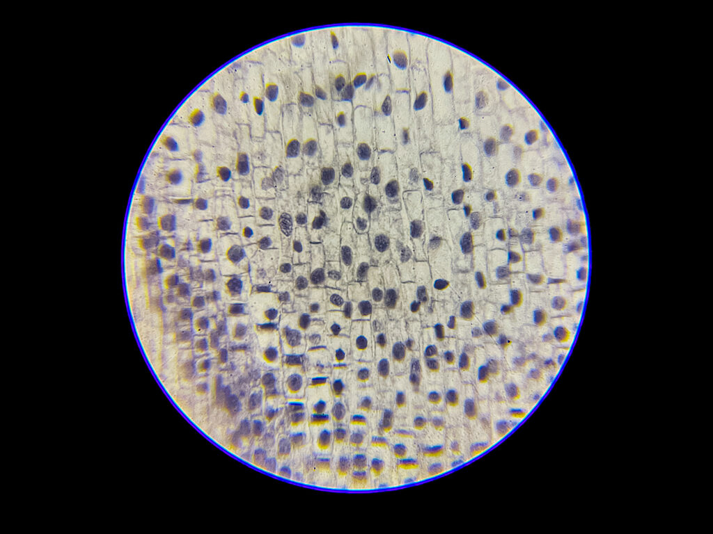 Onion Root Under Microscope - Mitosis Under Microscope---400x
