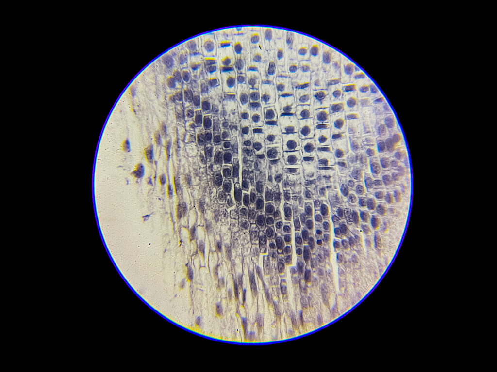 Onion Root Under Microscope - Mitosis Under Microscope----400x