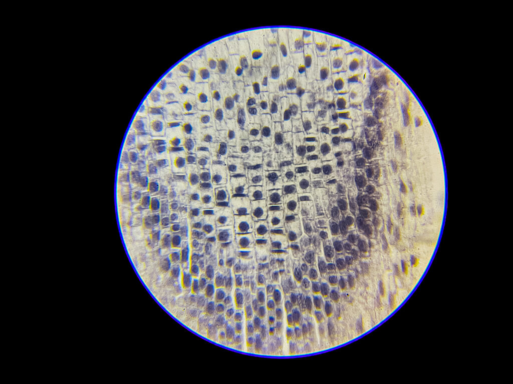 Onion Root Under Microscope - Mitosis Under Microscope--400x