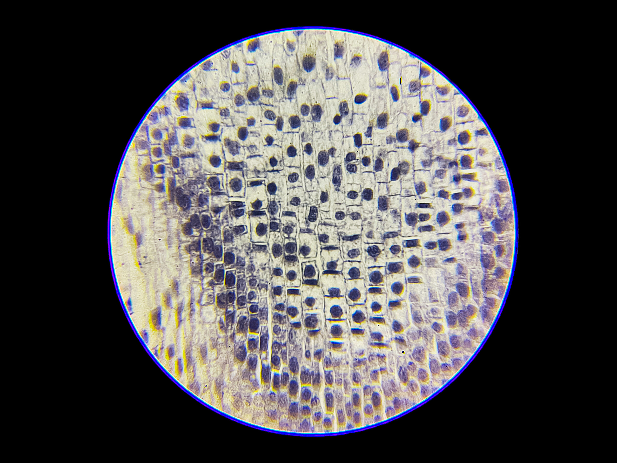 Onion Root Under Microscope - Mitosis Under Microscope-400x