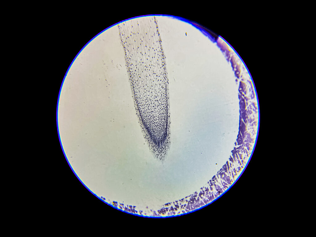 Onion Root Under Microscope - Mitosis Under Microscope - 40x