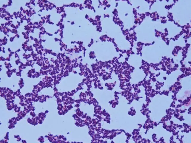 Staphylococcus aureus seen under microscope