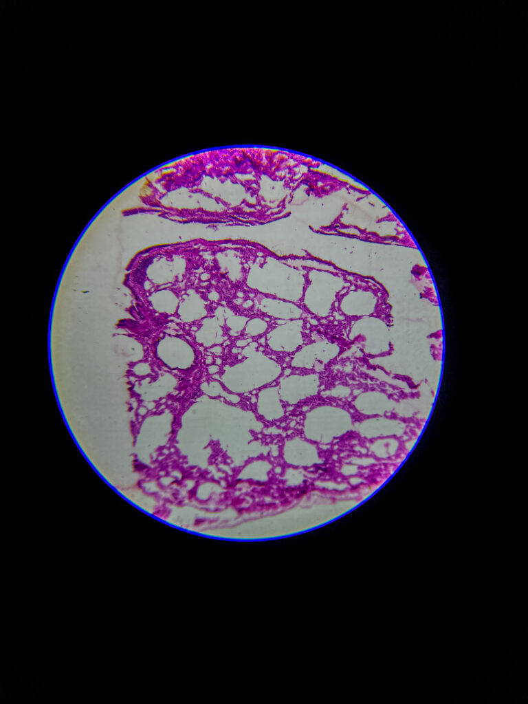 bronchus section under microscope