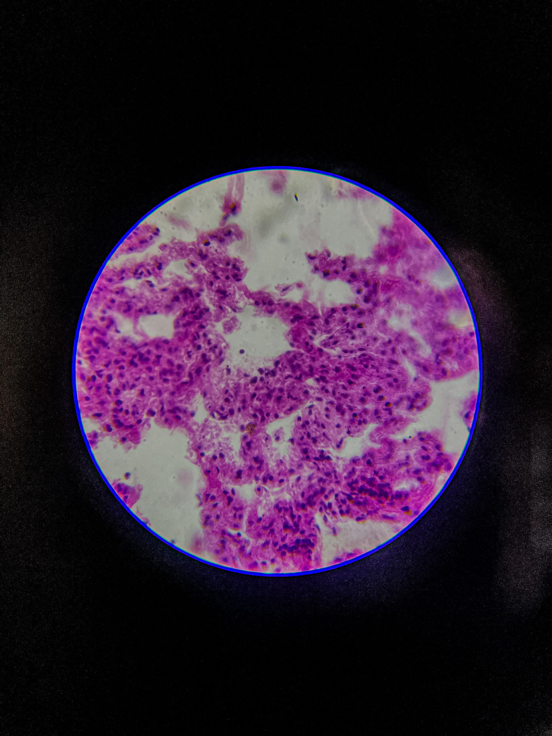 bronchus section under microscope