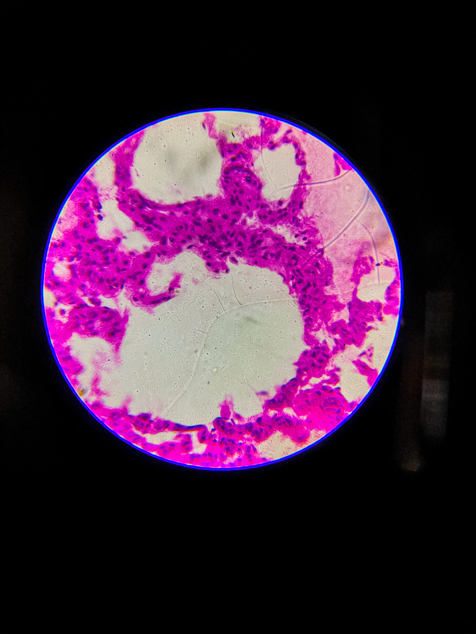 bronchus section under microscope