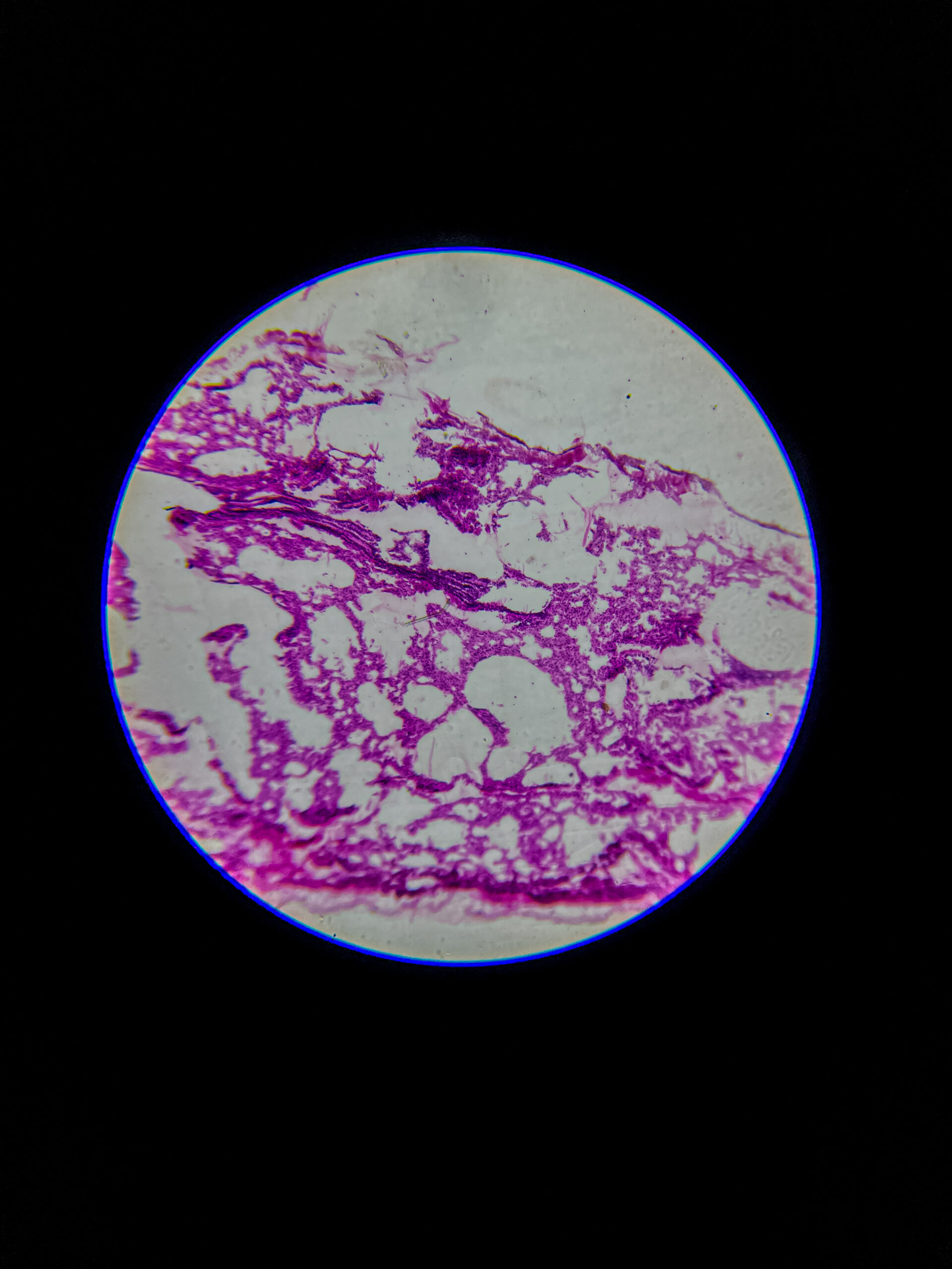 bronchus section under microscope