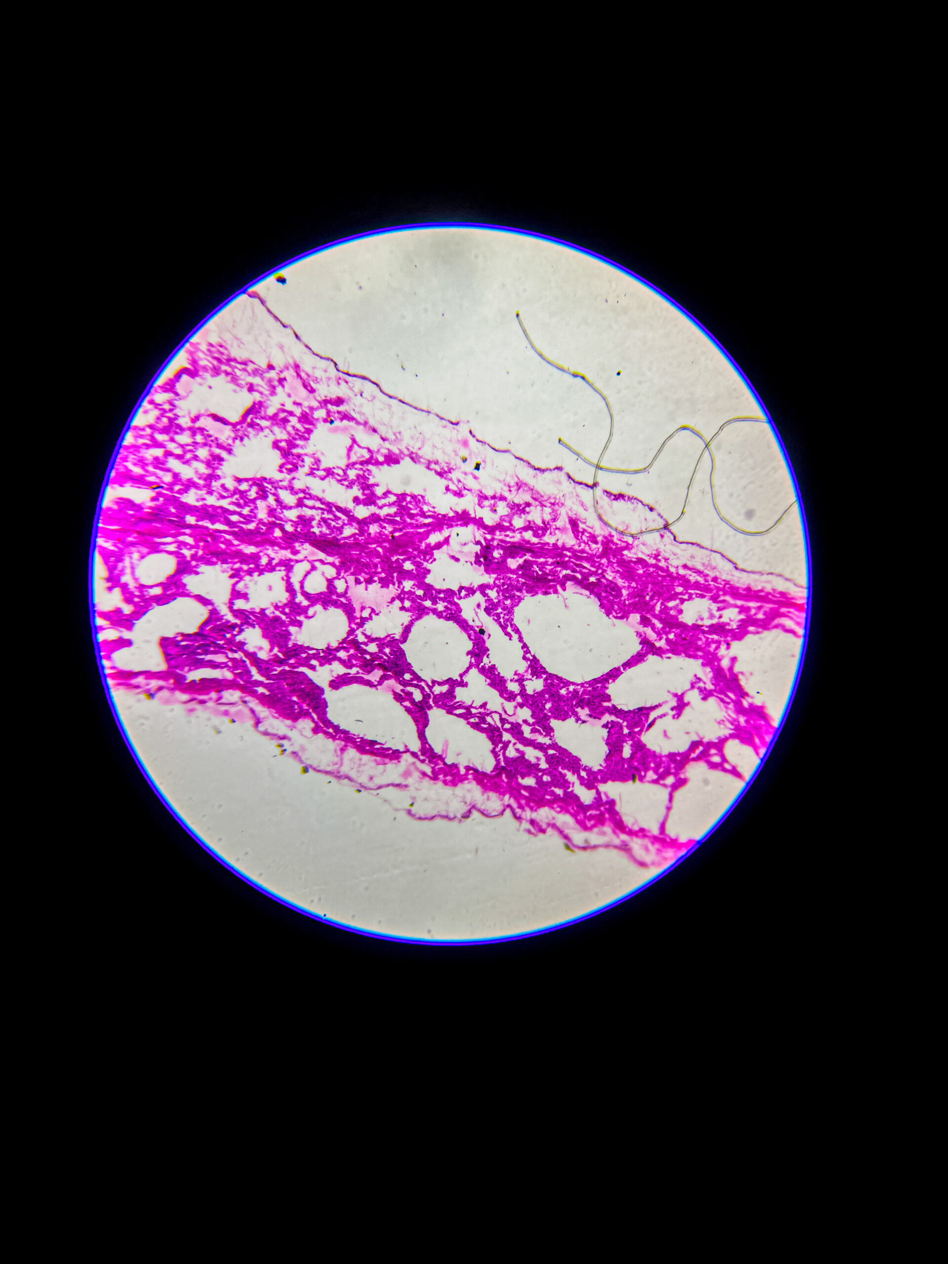 bronchus section under microscope