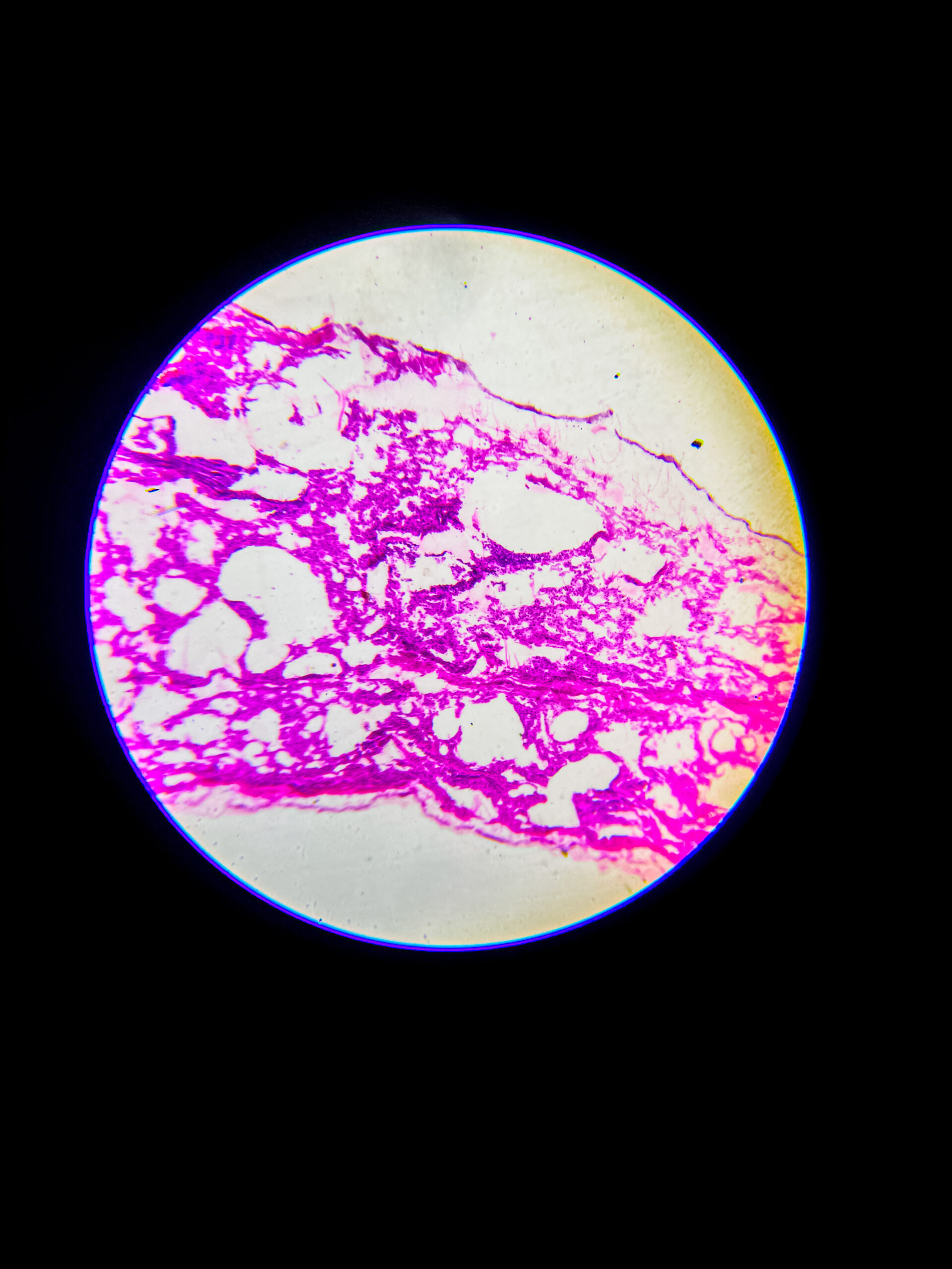 bronchus section under microscope