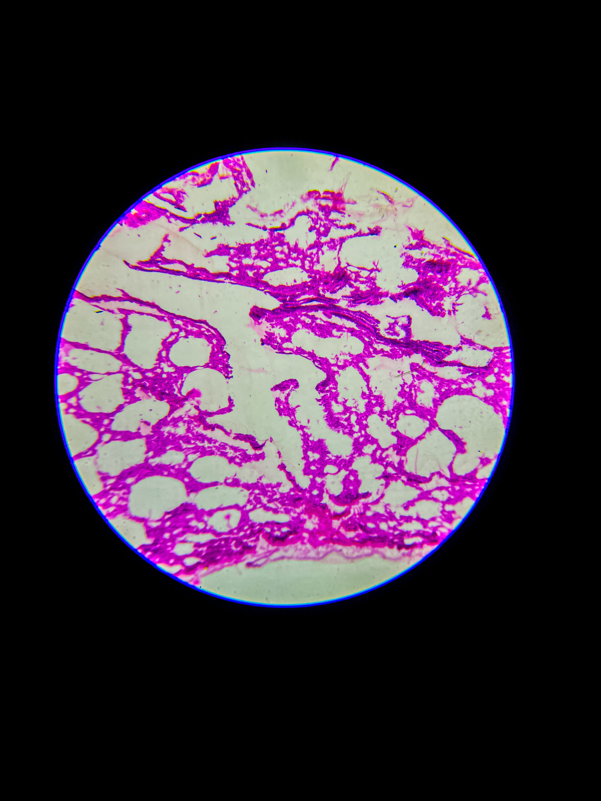 bronchus section under microscope