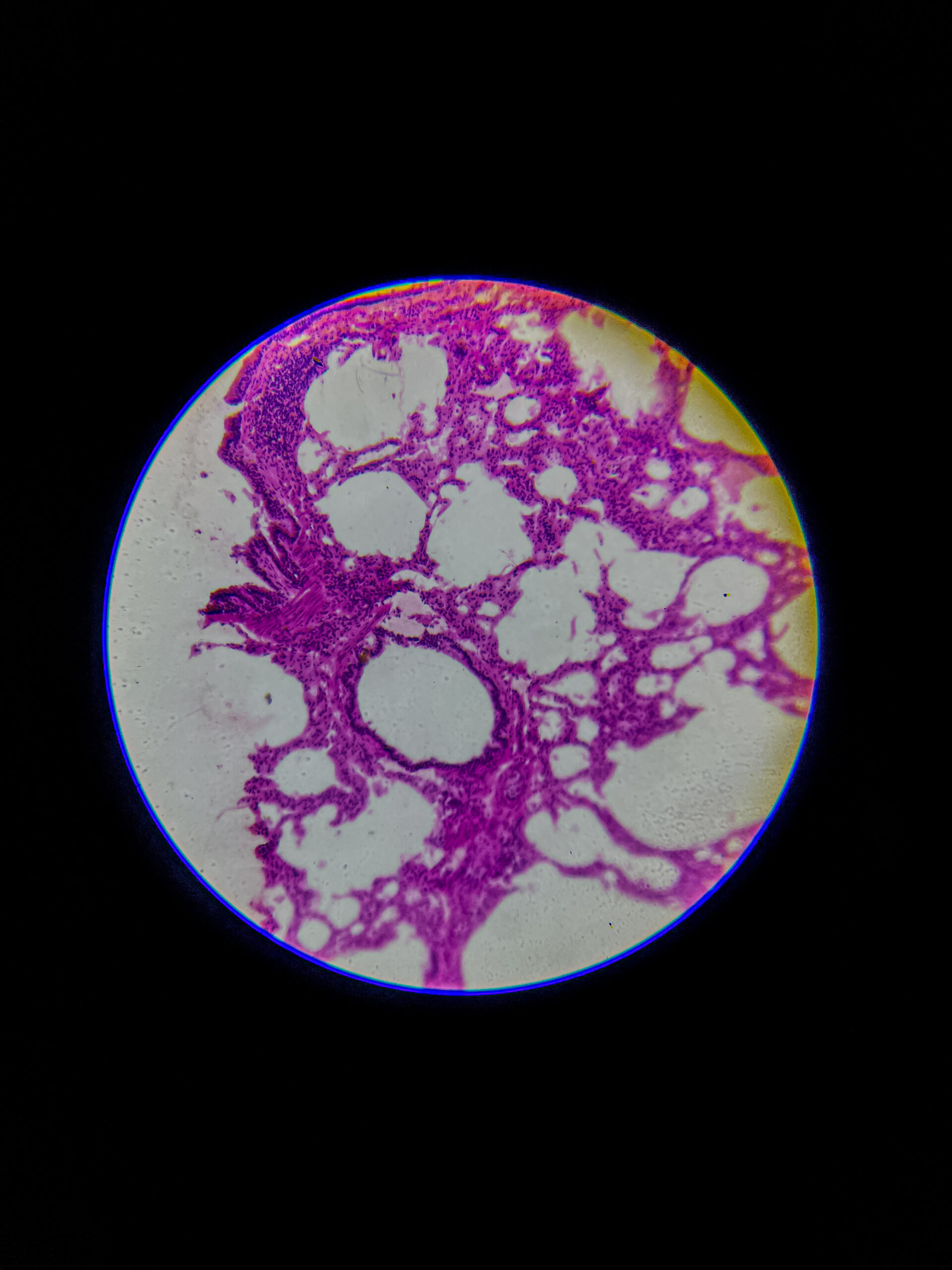 bronchus section under microscope