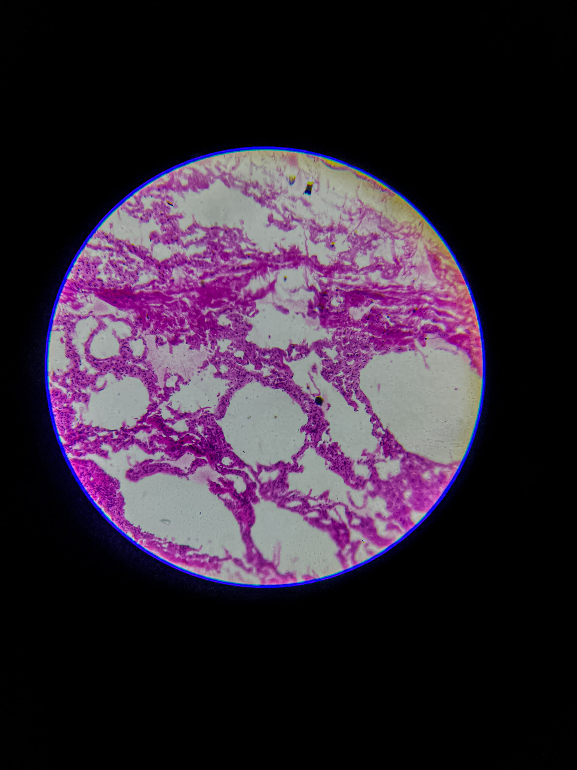 bronchus section under microscope