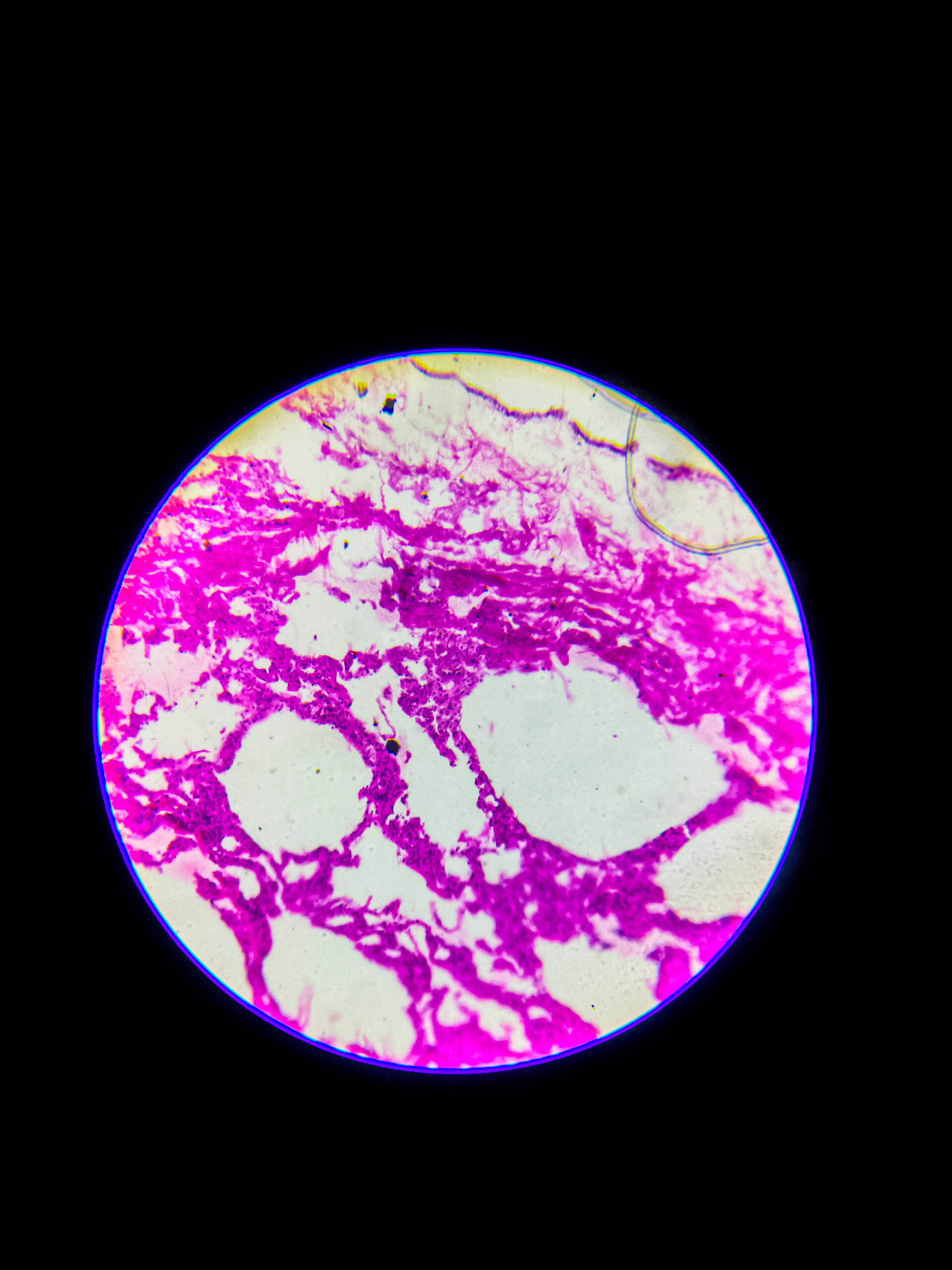 bronchus section under microscope