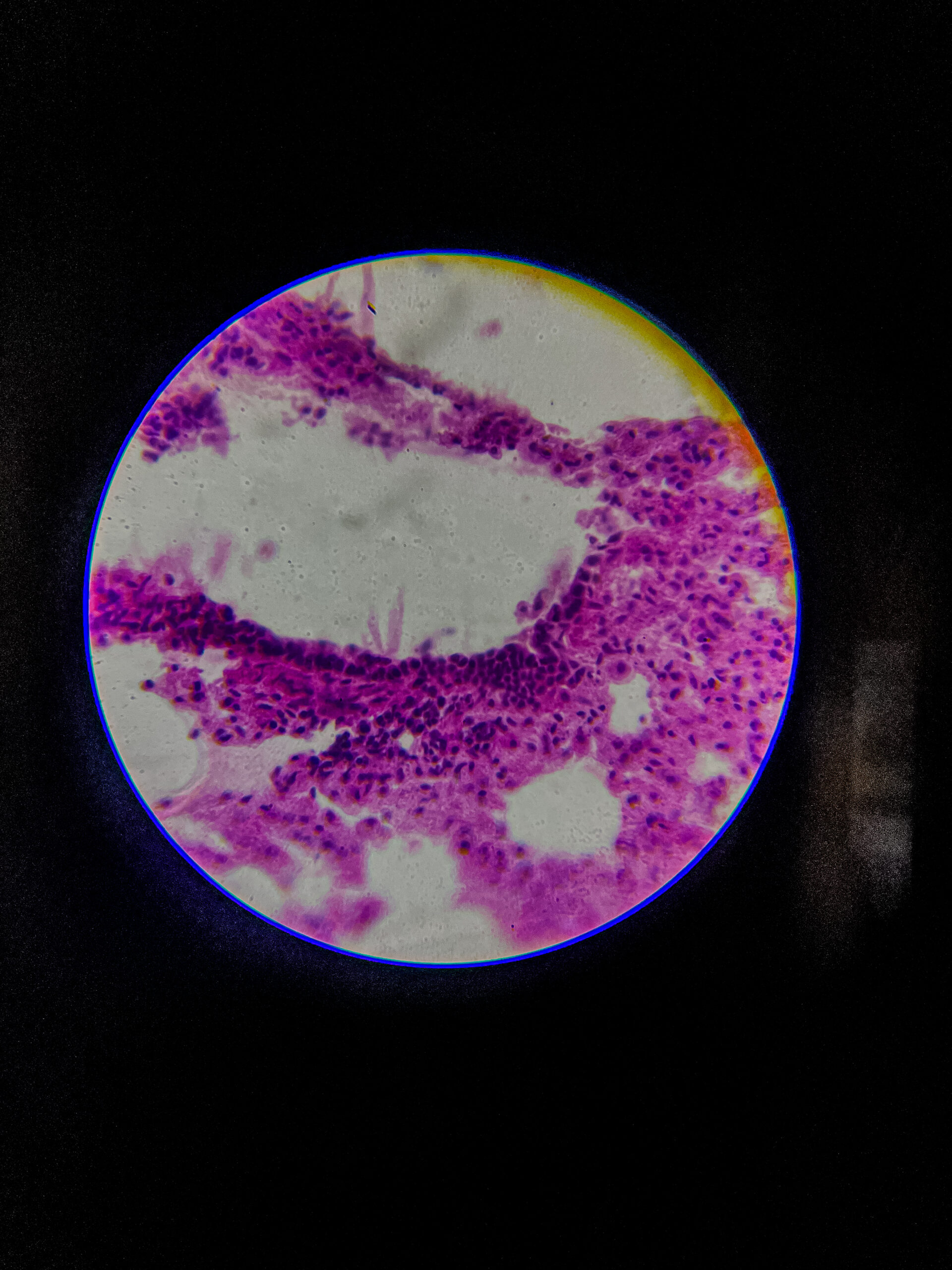 bronchus section under microscope