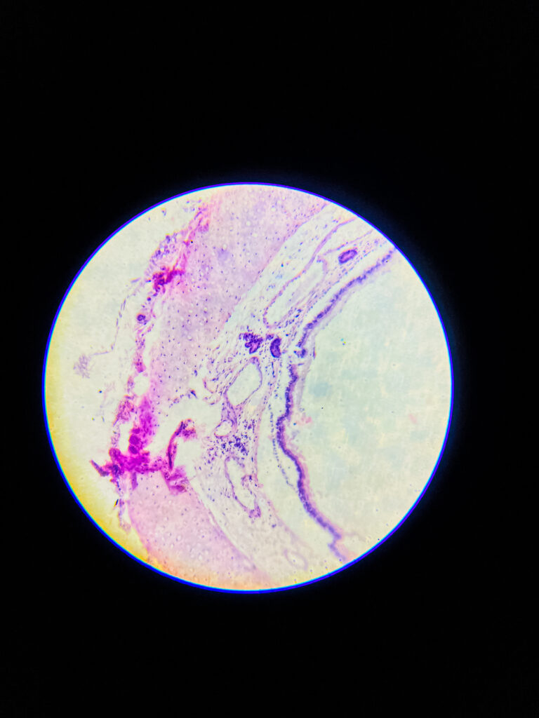 hyaline cartilage under microscope