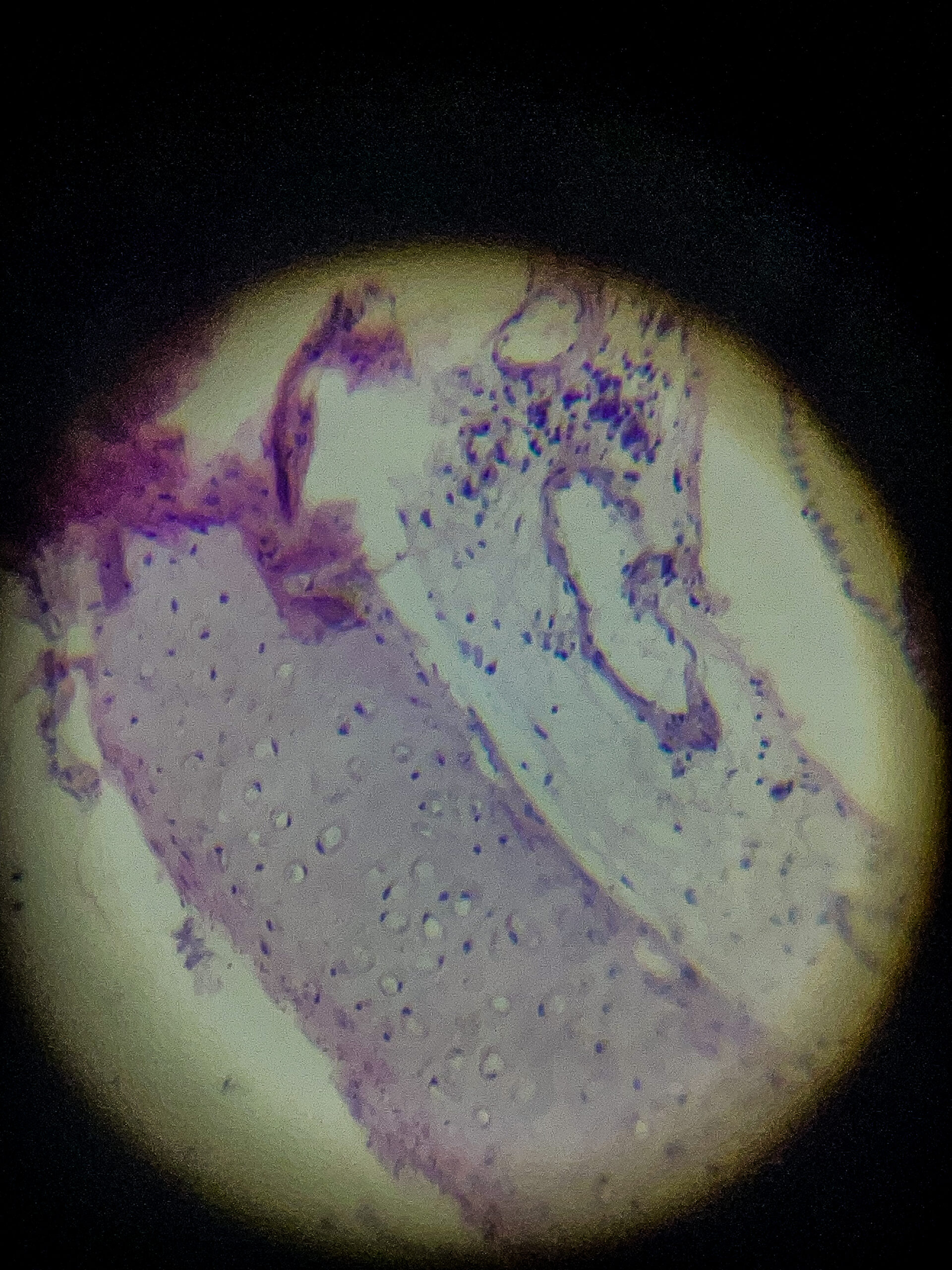 hyaline cartilage under microscope