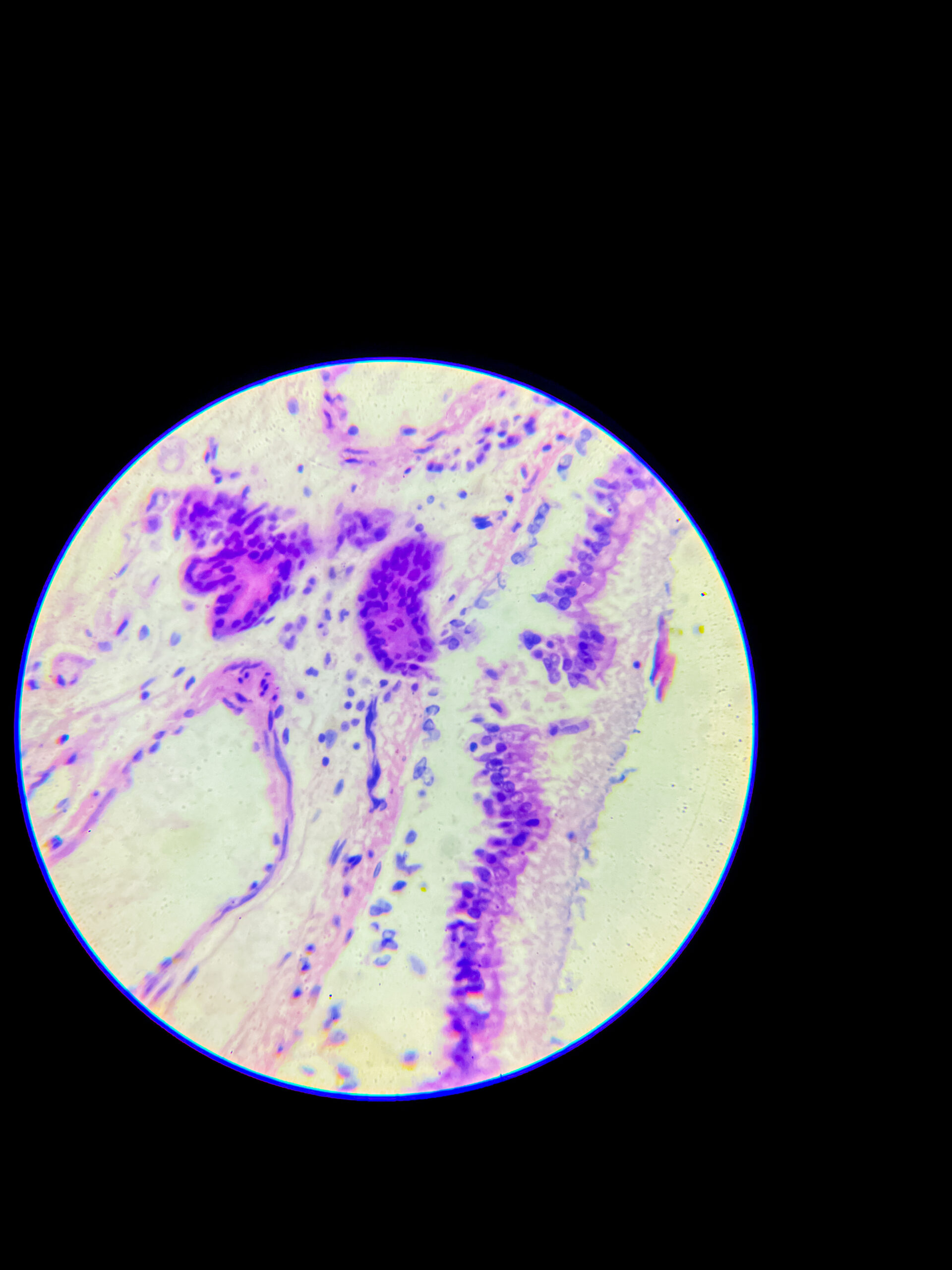 hyaline cartilage under microscope