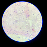 hyaline cartilage under microscope-3