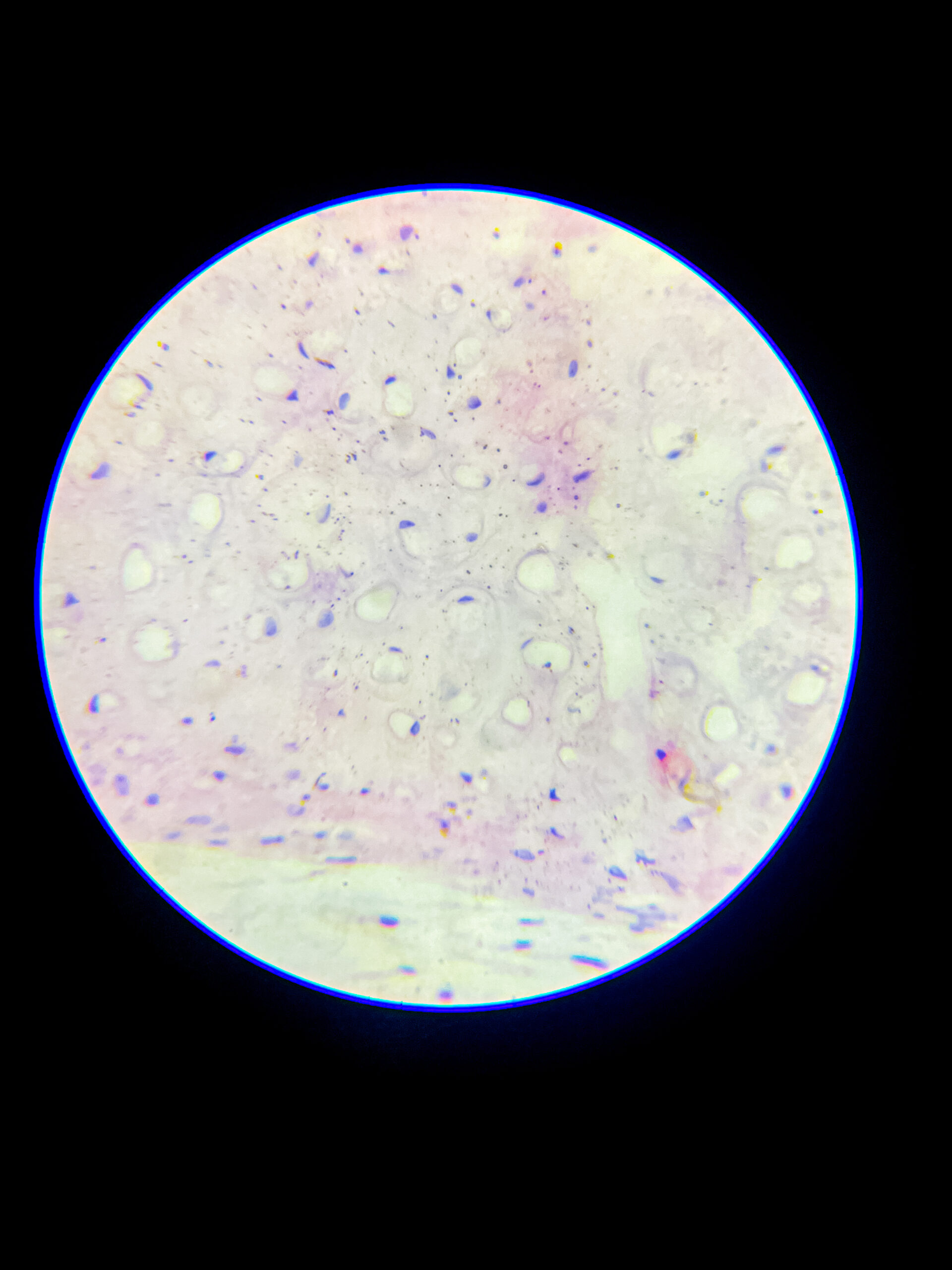 hyaline cartilage under microscope-3