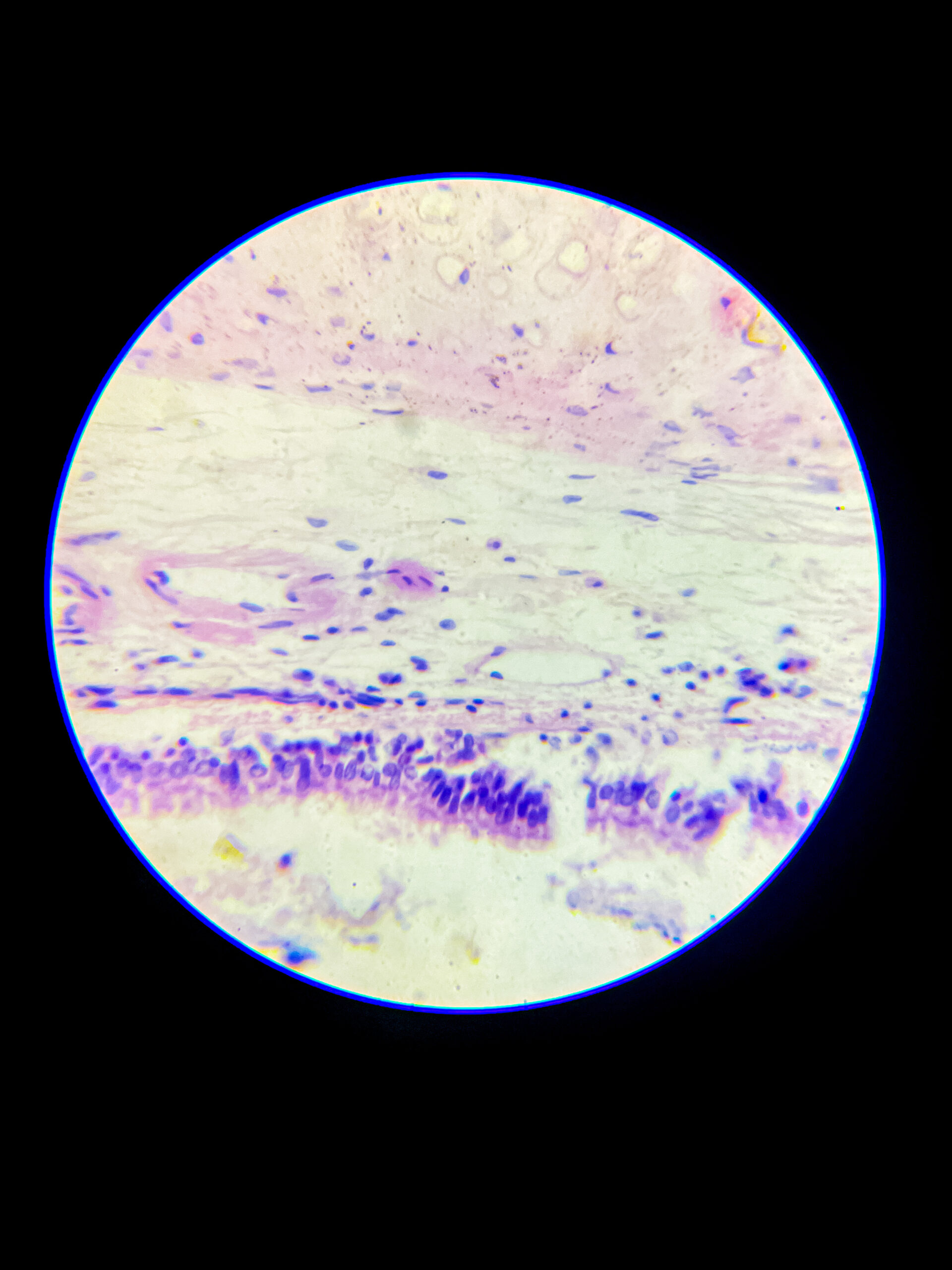 hyaline cartilage under microscope