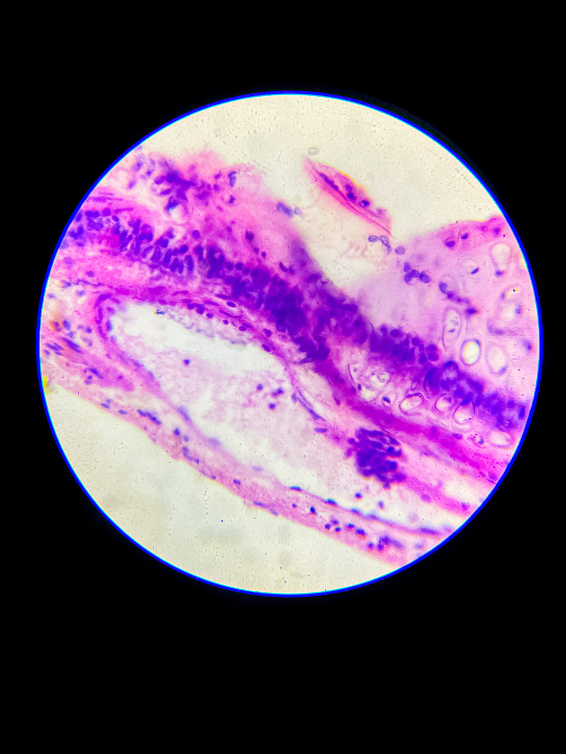 hyaline cartilage under microscope