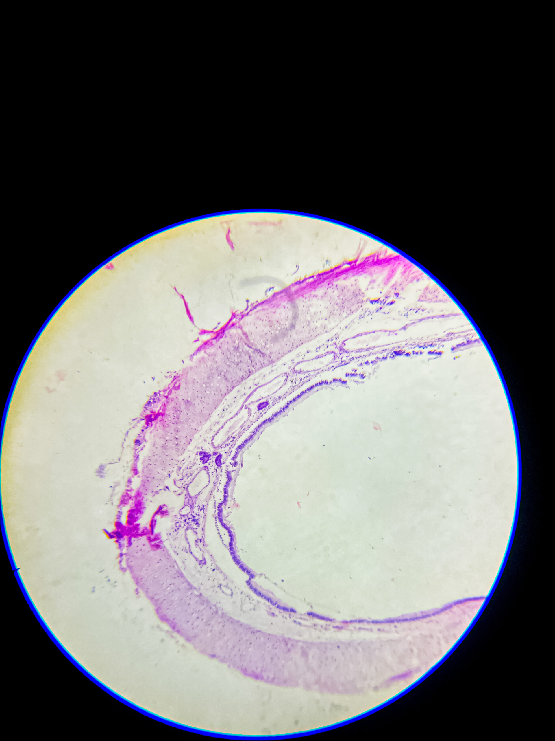 hyaline cartilage under microscope