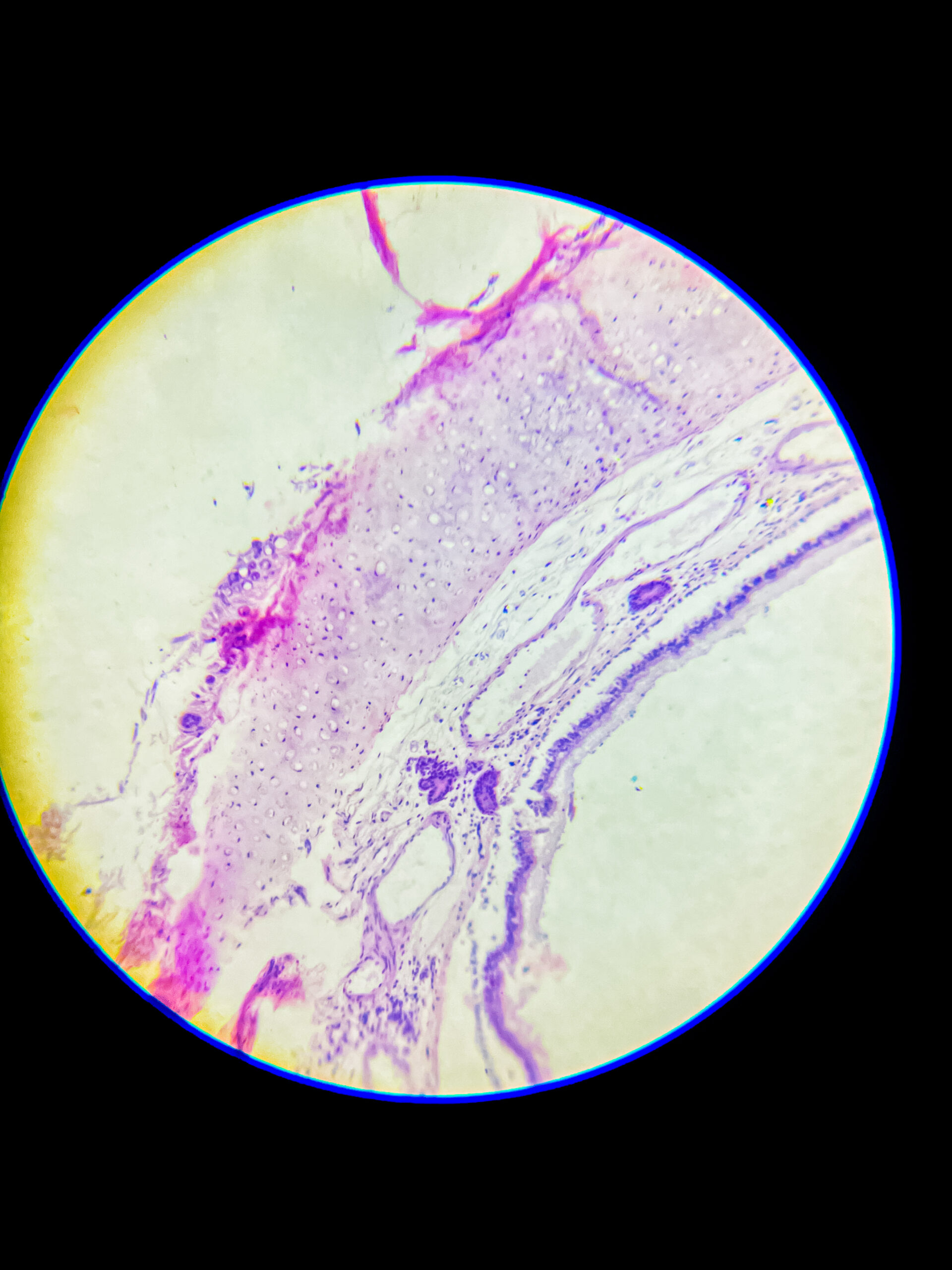 hyaline cartilage under microscope