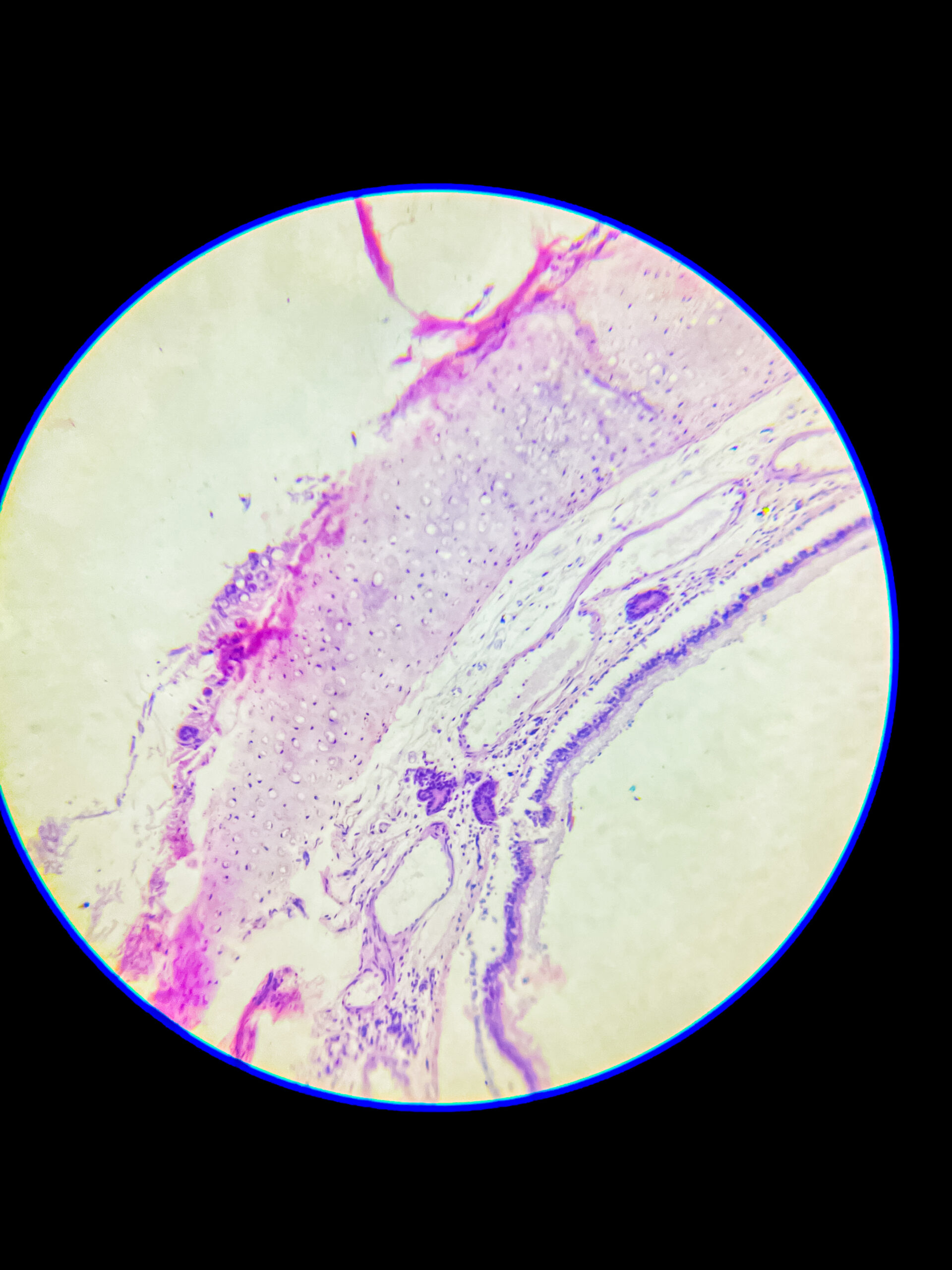 hyaline cartilage under microscope