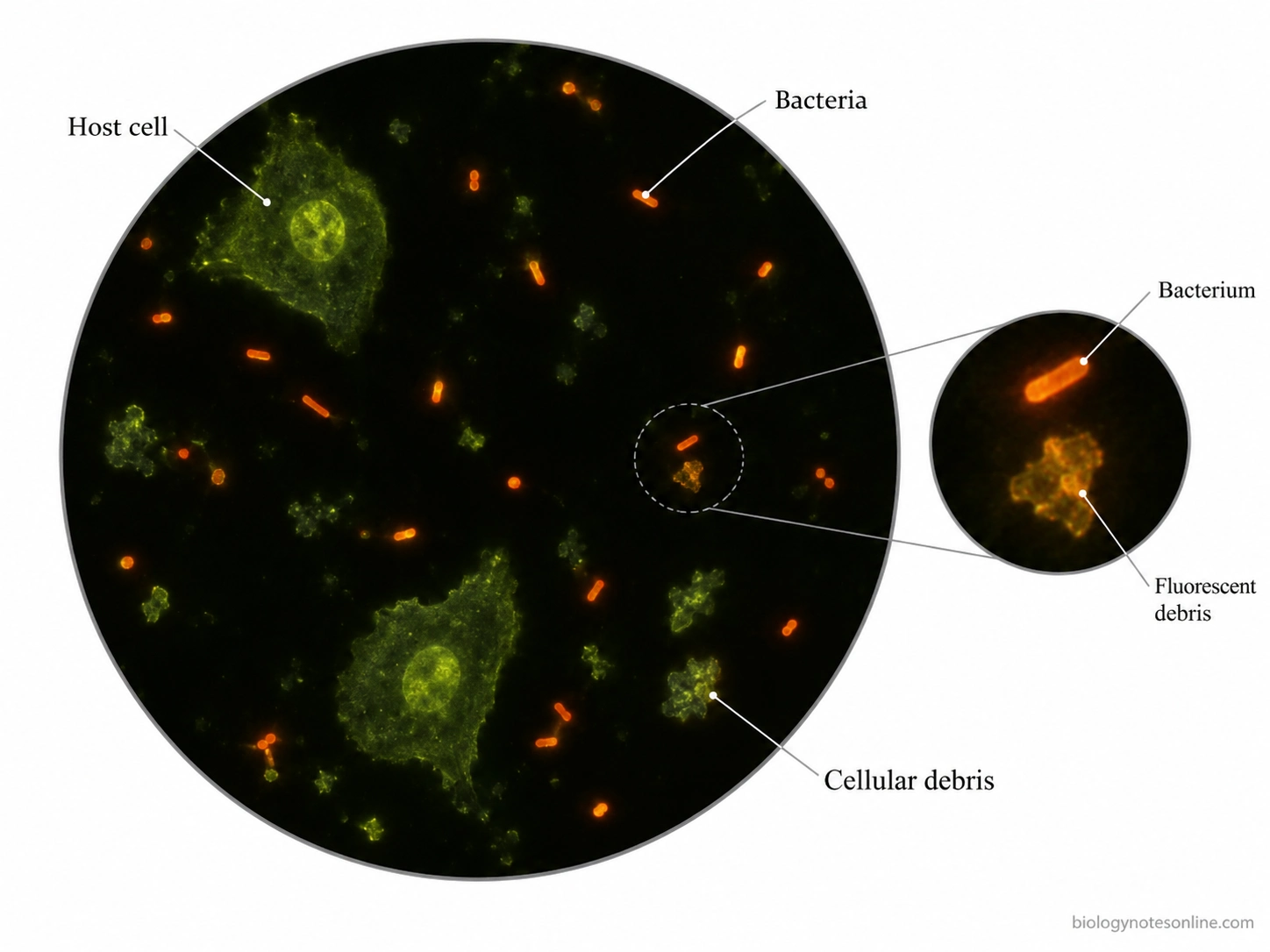 Fluorescence microscopy schematic showing bright orange bacterial cells, green-yellow host cells, and fluorescent debris in an acridine orange-stained clinical smear.