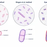 Comparison of bacterial cell wall staining results: pink-red walls in Chance's method, violet walls in Ringen's method, and red walls with blue cytoplasm in Dyar's method.