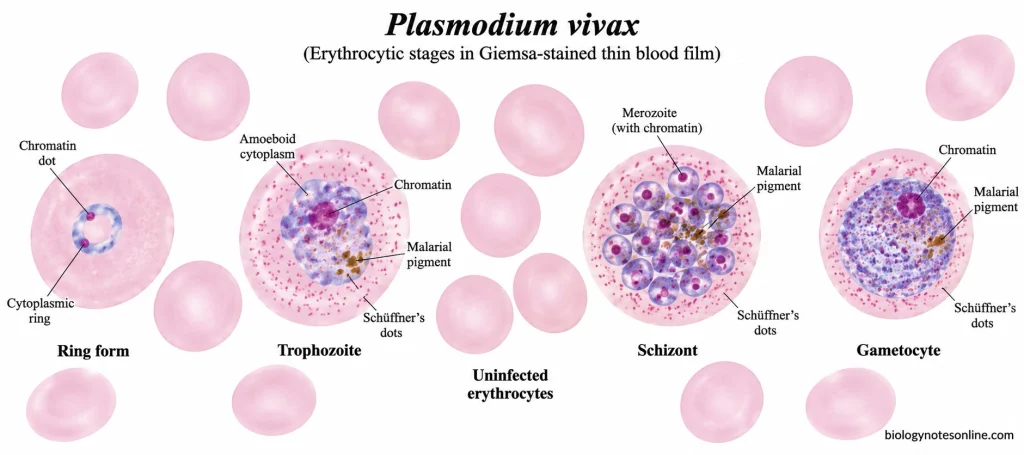 Giemsa-stained Plasmodium vivax in erythrocytes showing ring-form trophozoite, amoeboid trophozoite, mature schizont and rounded gametocyte with characteristic staining features.