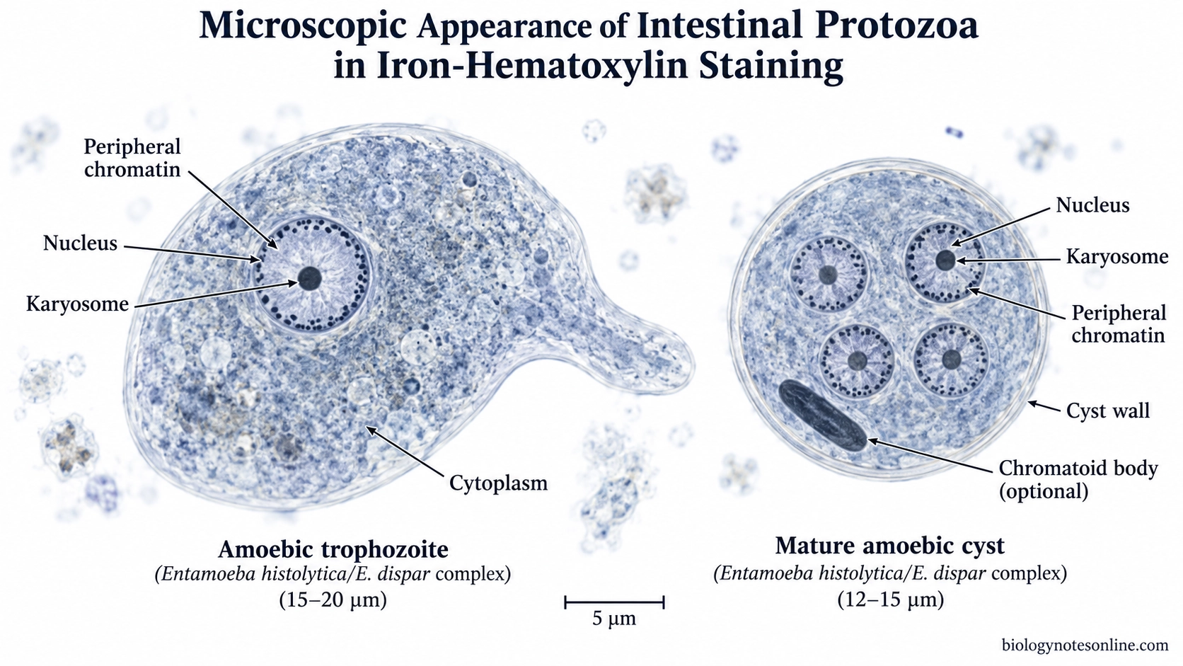 Iron-hematoxylin-stained amoebic trophozoite with one nucleus beside a mature four-nucleated cyst, showing karyosomes, peripheral chromatin and grey-blue cytoplasm.