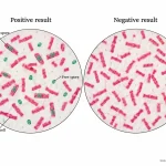 Positive endospore staining shows green intracellular or free spores, while a negative preparation shows no visible green endospores. A negative result does not always exclude the ability of a bacterial species to form spores.