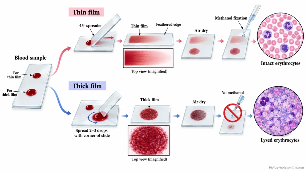 Thin blood films are fixed with methanol to preserve erythrocyte morphology. Thick blood films remain unfixed, allowing erythrocytes to lyse during staining and leaving blood parasites concentrated for microscopic examination.