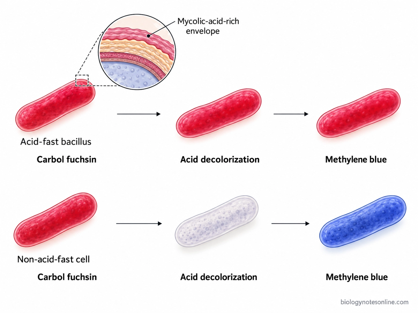 Diagram showing acid-fast bacilli retaining red carbol fuchsin after acid treatment, while non-acid-fast cells become blue after counterstaining.