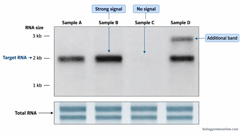Illustrative Northern blot with four sample lanes showing different target RNA band intensities, an undetected signal, an additional RNA band, an RNA size reference, and total-RNA loading controls.