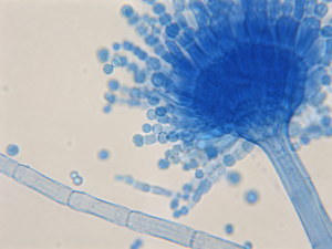 Individual Aspergillus conidia and part of a conidial head at 1000× oil immersion