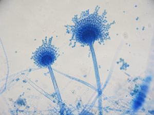 Aspergillus conidiophore with vesicle and blue-stained conidia at 400× brightfield magnification