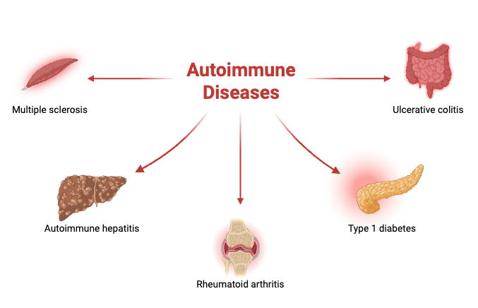 Autoimmune Disease - Definition, Types, Diagnosis, Treatment, Examples 4 Autoimmune Diseases