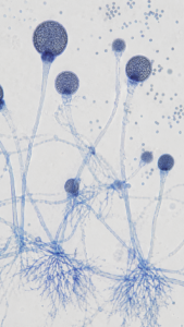 Bread Mold – Rhizopus Under Microscope