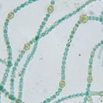 Cyanobacteria (Anabaena) Under Microscope - Microscopic Picture of Cyanobacteria (Anabaena)