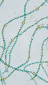 Cyanobacteria (Anabaena) Under Microscope – Microscopic Picture of Cyanobacteria (Anabaena)