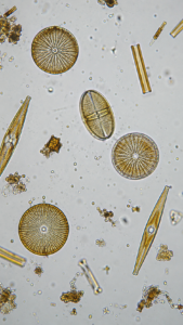 Diatoms Under Microscope – Microscopic Picture of Diatoms