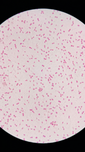 Gram Negative Rods – Escherichia coli
